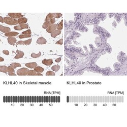 KBTBD5 Antibody, Novus Biologicals 0.1mL; Unlabeled:Antibodies, Polyclonal